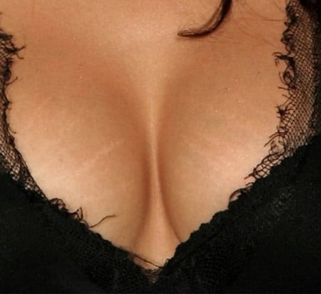 Растяжки на груди огорчают женщин